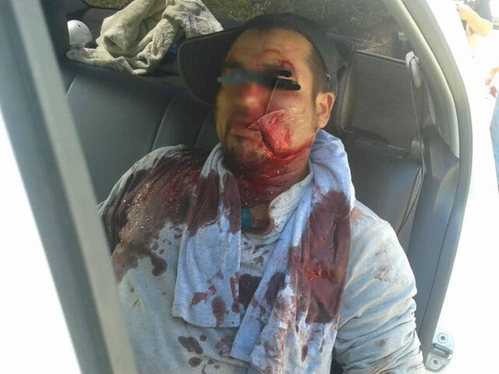 Dos trabajadores de Sedari Chocan  contra Volquete, pero viven