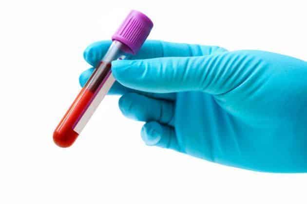 Impulsa Issste Donación De Sangre