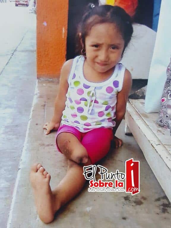 Madre de familia de escasos recursos solicita apoyo para viajar a la capital del Estado