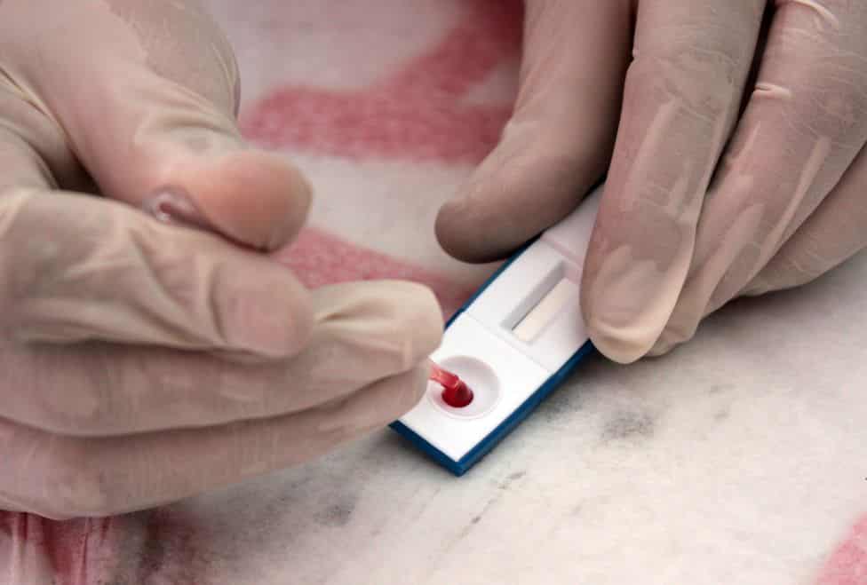 Exhorta DH a SESA a no suspender aplicación de pruebas a pacientes con VIH