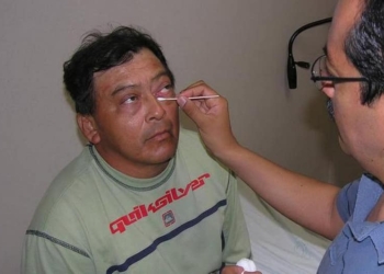 Conjuntivitis, tendrá descenso en el sur, pero se agudizará en el norte de Q. Roo