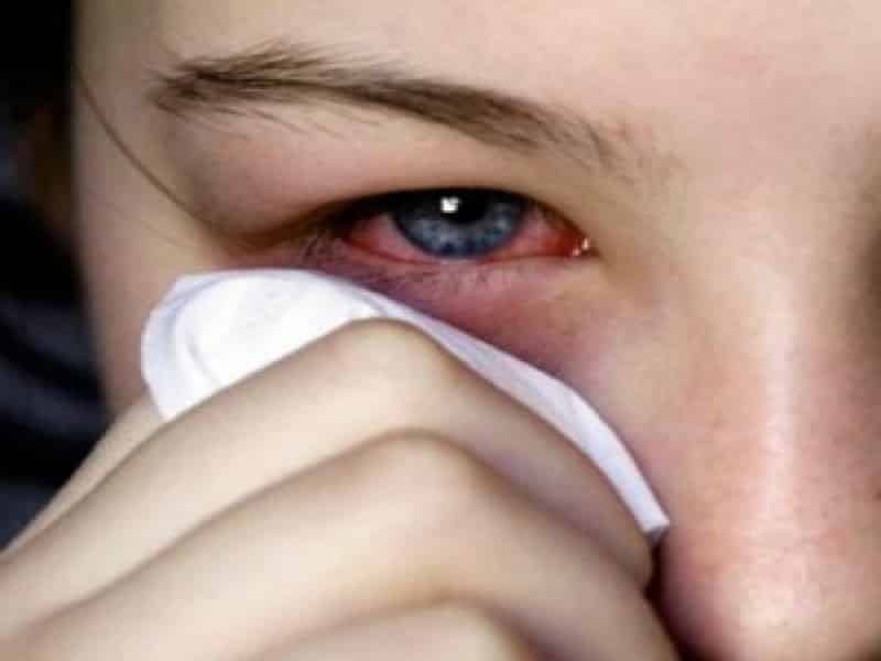 Frentes fríos reducen proliferación de Conjuntivitis en Q. Roo