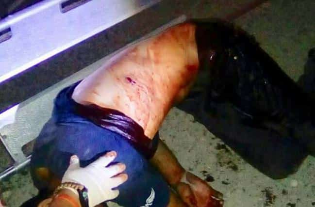 Baleado, fallece en el hospital presunto narcomenudista