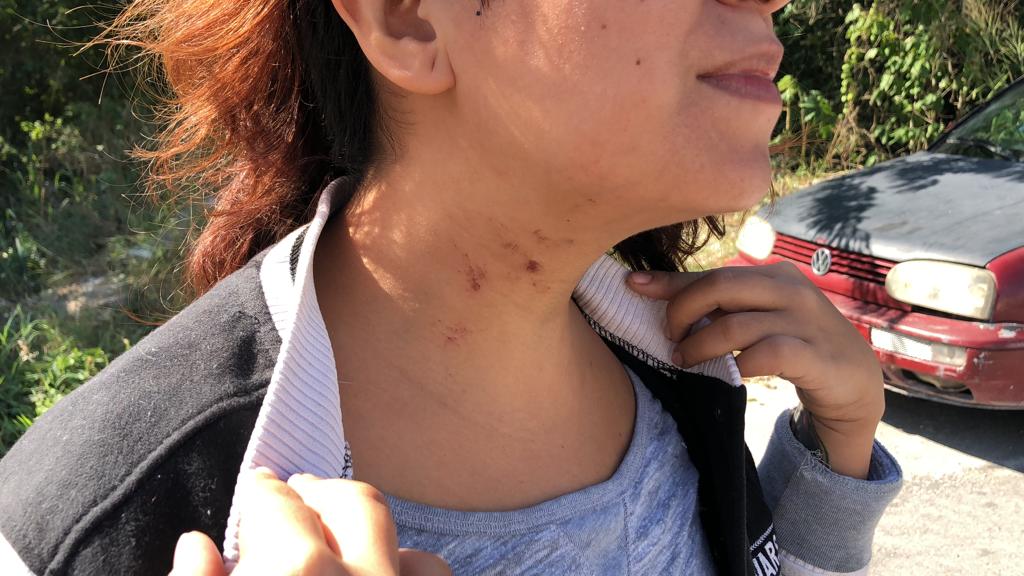 Violan e intentan estrangular a joven playense