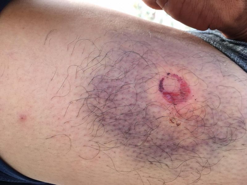 Abuso policiaco en Felipe Carrillo Puerto