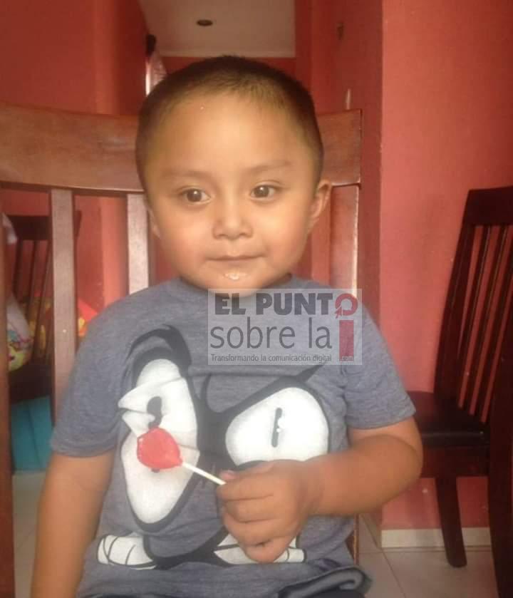 El pequeño, Christoper Nadir, requiere con urgencia el apoyo de la sociedad; habrá evento con causa