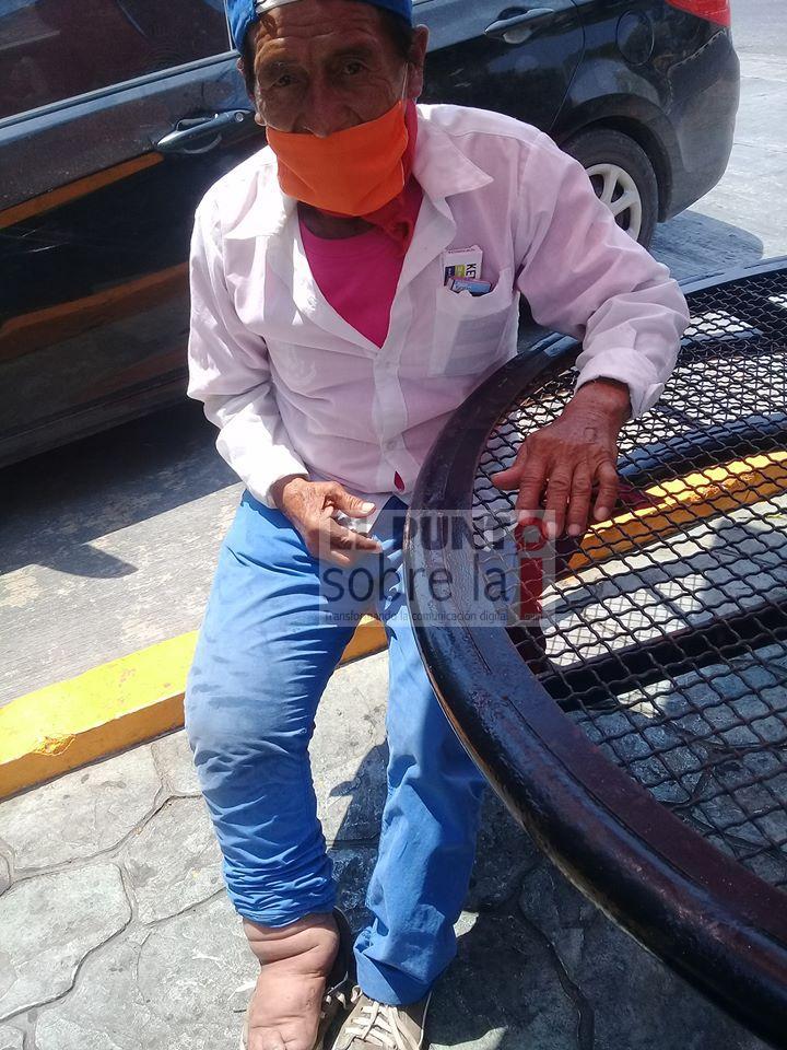 Teme dejar sin comer a su familia, aún con su inconveniente estado de salud continúa trabajando