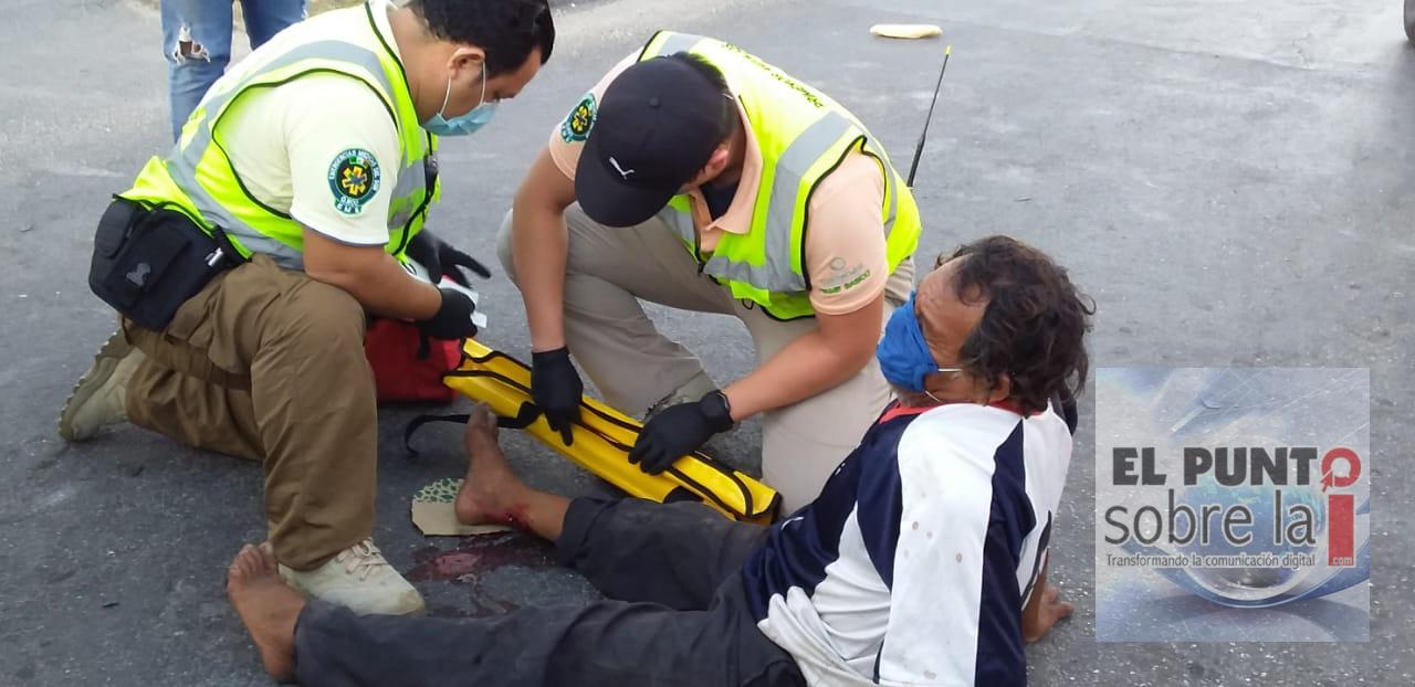 Terminó con una pierna fracturada