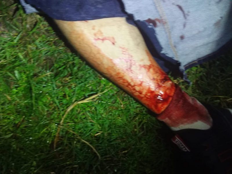 Balean a 2 personas en Bacalar