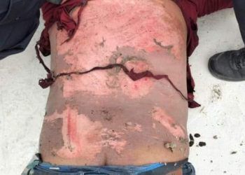 Por poco muere electrocutado