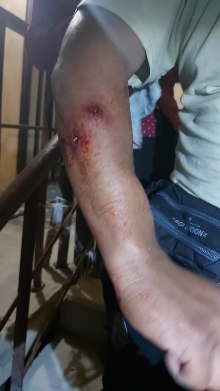 Impide agresión a mujer y lo balean en Cancún
