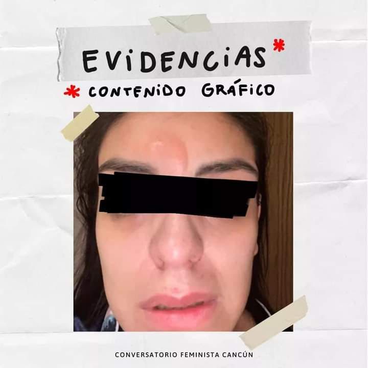 Acusan a ex alcalde de Cozumel de violencia contra ex pareja