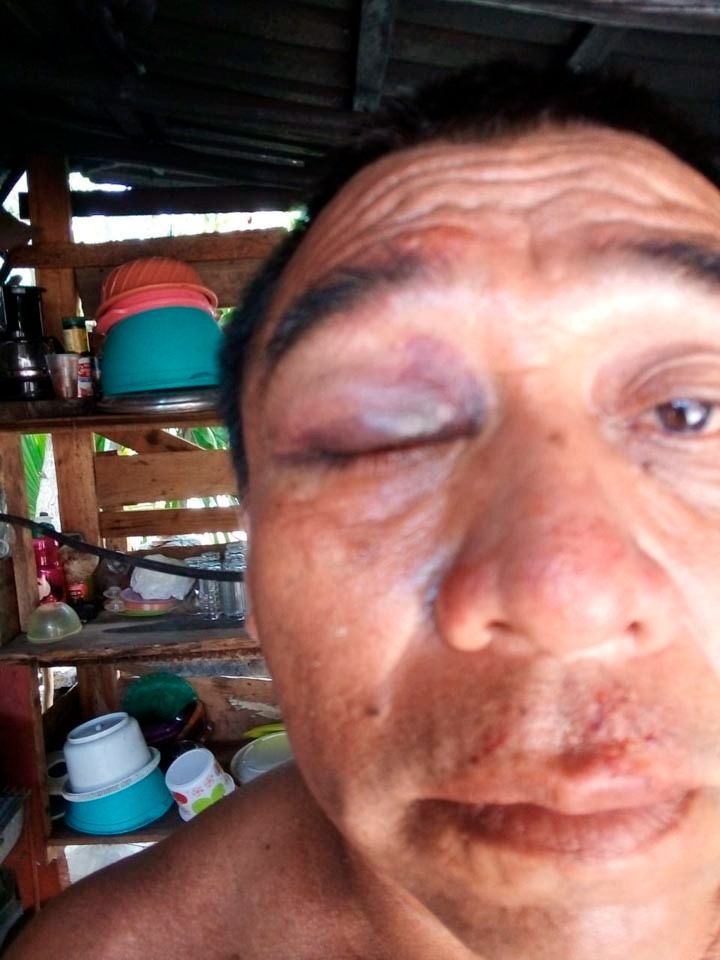 Denuncian en Puerto Morelos a miembros del equipo de campaña de Carmen Joaquín por lesiones y amenazas
