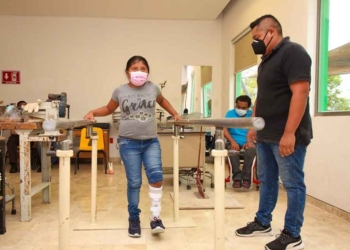 Niña de comunidad de Ocum, recibe prótesis de pie que la ayudará a mejorar su calidad de vida