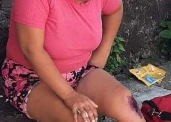 Le dan su llegue a una mujer cuando caminada sobre la banqueta