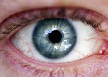 Enfermedades raras pueden comprometer la salud ocular