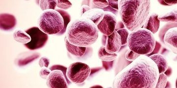 Llega a México innovadora terapia para pacientes con anemia por Síndrome Mielodisplásico
