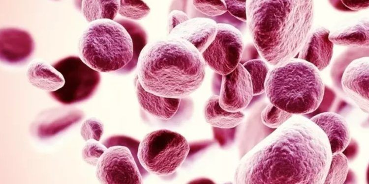 Llega a México innovadora terapia para pacientes con anemia por Síndrome Mielodisplásico