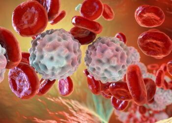 Un Hito en el Tratamiento de la Leucemia Linfoblástica Aguda