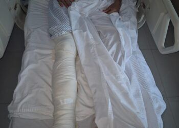 Cozumeleño atropellado por repartidor vive en carne propia negligencias del IMSS