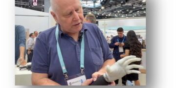 Innovaciones ortopédicas revolucionan la rehabilitación y calidad de vida de personas amputadas